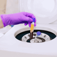 Advanced regenerative medicine treatment being prepared at Performance Pain and Sports Medicine for injury recovery and pain management.