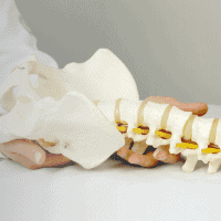 Spinal model showing vertebrae and discs for back pain diagnosis and treatment.