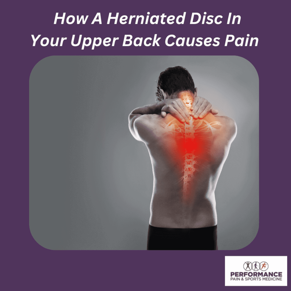 Herniated disc pain upper back, spine inflammation, spinal disc injury, back pain relief, sports medicine herniated disc treatment.