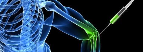 Medical professional administering injections to a knee joint for pain relief or sports injury treatment at Performance Pain and Sports Medicine.