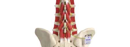 Sharp focus on spinal nerves illustrating nerve compression and pain management in sports medicine and pain treatment.