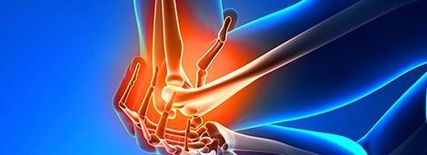 Hand and wrist pain imaging showing injury and inflammation in the bones and soft tissues. Focuses on pain relief and sports medicine treatments for hand, wrist, and forearm injuries.