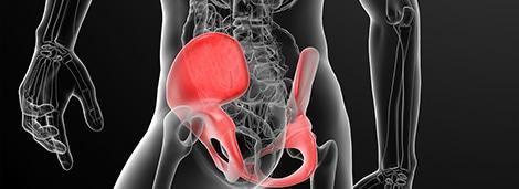 Severe hip and pelvic pain highlighted with red areas in a digital medical illustration, focusing on sports injuries and pain management.