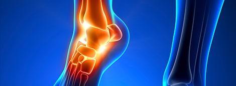 High-resolution digital rendering of knee joint pain highlighting inflammation and injury, colorful medical illustration emphasizing diagnosis and treatment options at Performance Pain and Sports Medicine.