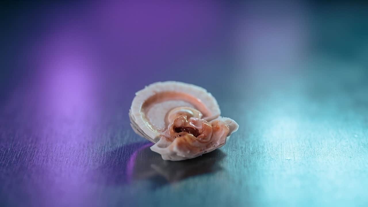 What Causes Disc Height Loss