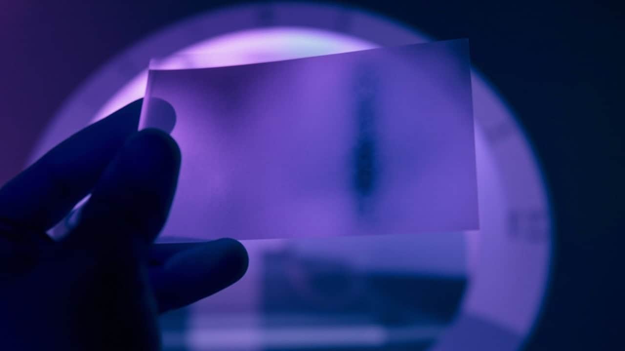 What Does an MRI Show?